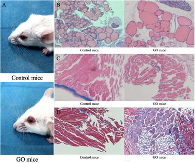 Exploring the Role of SRC in Extraocular Muscle Fibrosis of the Graves’ Ophthalmopathy